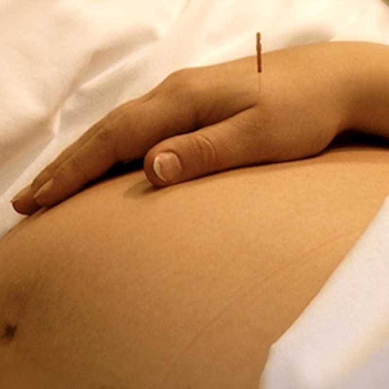 Clínica de Acupuntura para Gestante Vila Morumbi - Clínica de Acupuntura para Endometriose