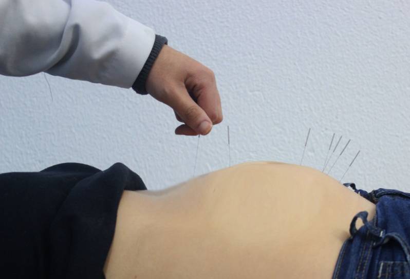 Consultório de Acupuntura para Enxaqueca Vila Progredior - Consultório de Acupuntura para a Coluna Cervical