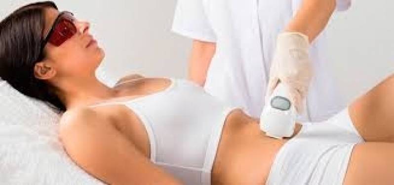 Dermato Funcional Laser Jardim Everest - Dermato Funcional Abdominoplastia