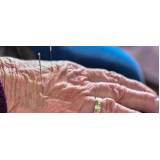acupuntura para idosos Vila Progredior