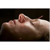 clínica de acupuntura para dor nas costas