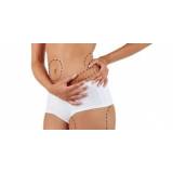 dermato funcional abdominoplastia Jardim Panorama D'Oeste